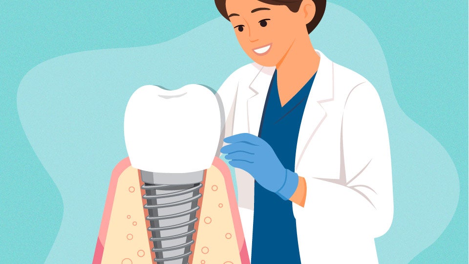 female dentist working on tooth crown