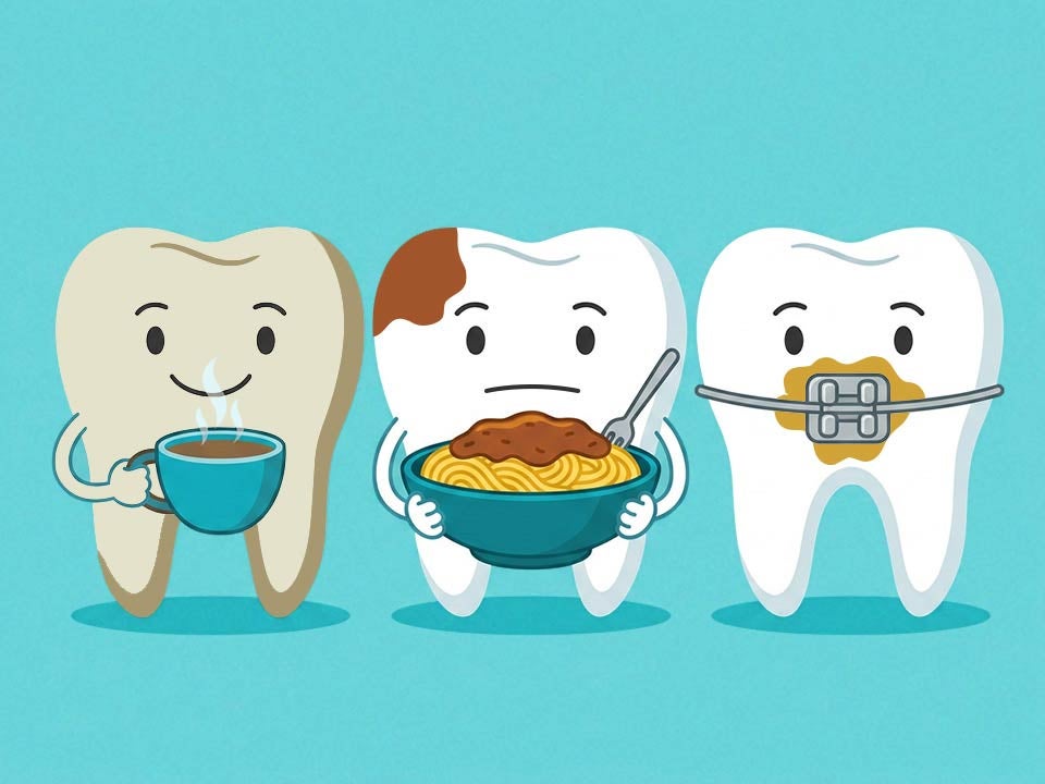 3 Teeth discolored in different ways