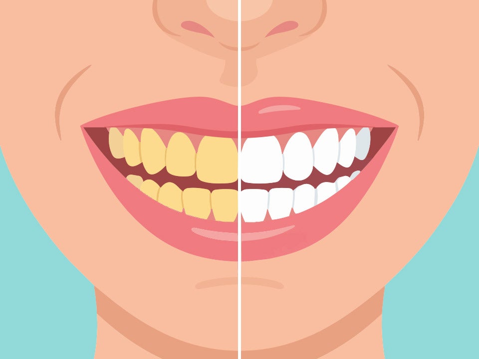 Smiling face, half yellow teeth, half white teeth