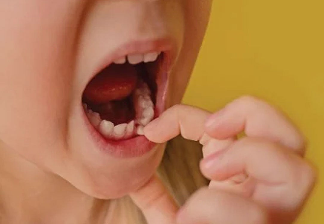 Stock photo of child pushing on a loose baby tooth