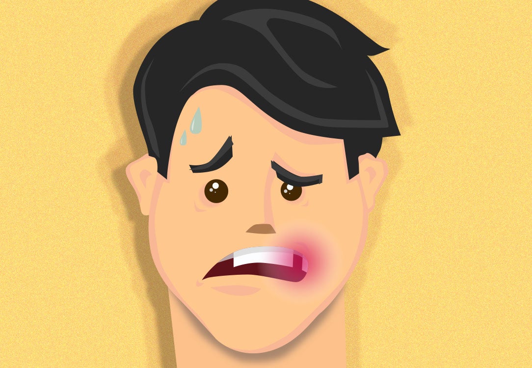 Man sweating with an empty socket on a yellow background