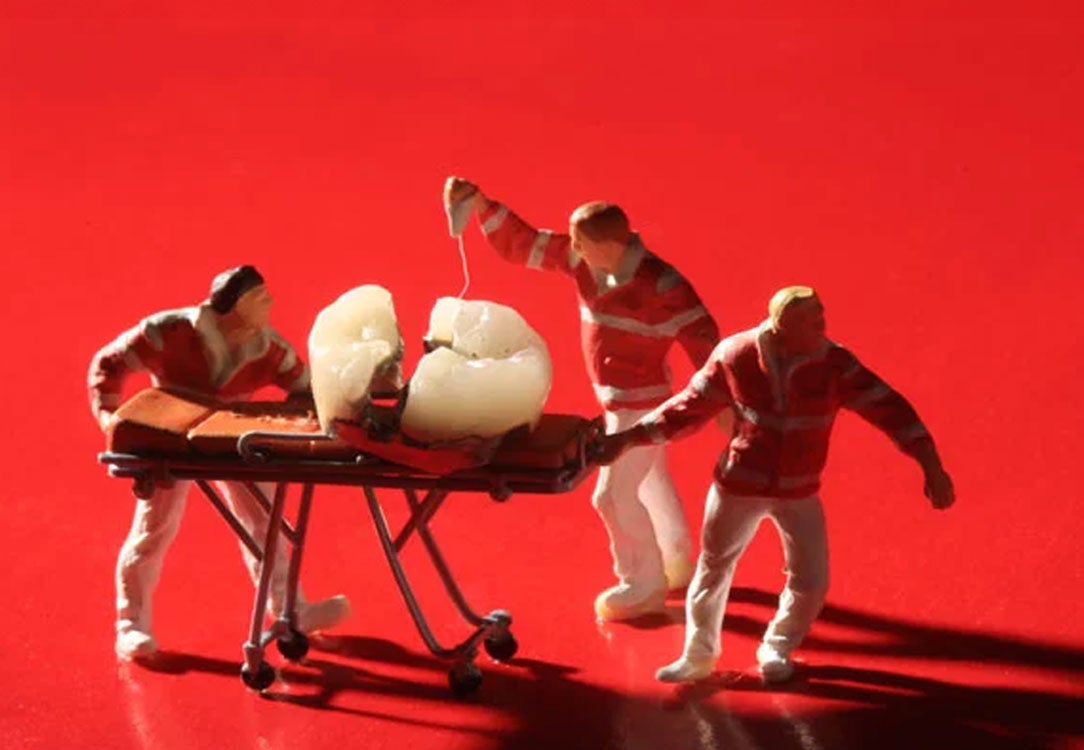 Three men pulling a broken tooth on a stretcher