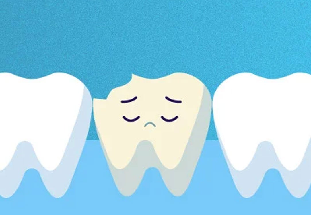 Sad stained chipped tooth between two bright teeth