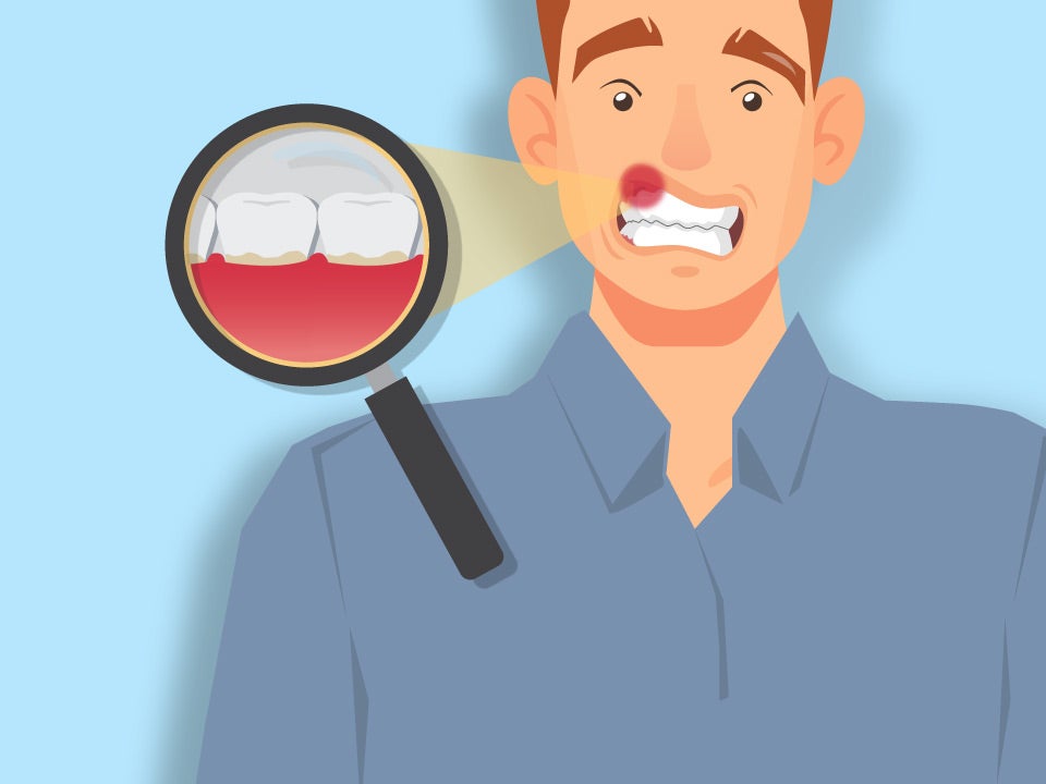 Man with periodontal disease looking concerned