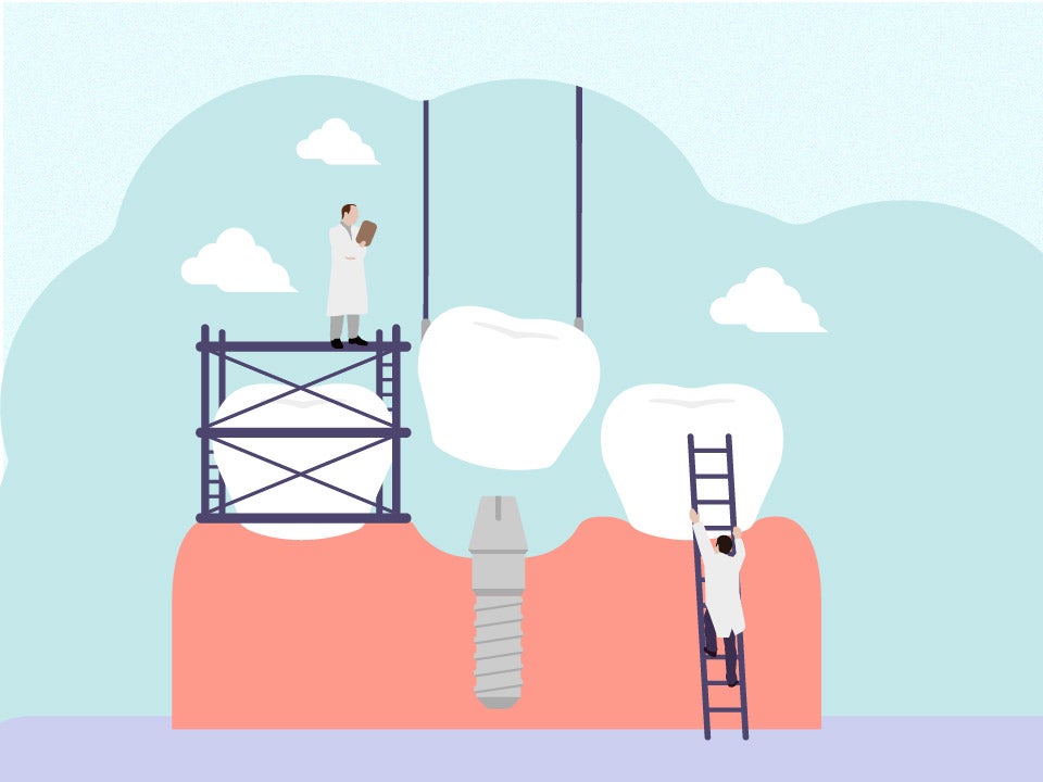 teeth under construction