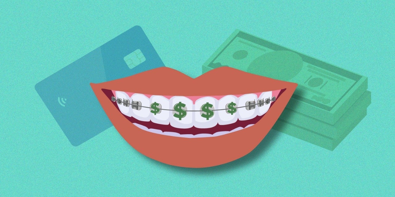 Braces with money