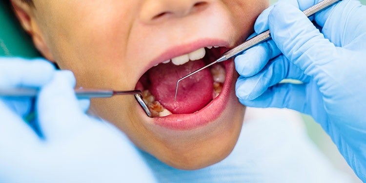 Child getting cavity exam