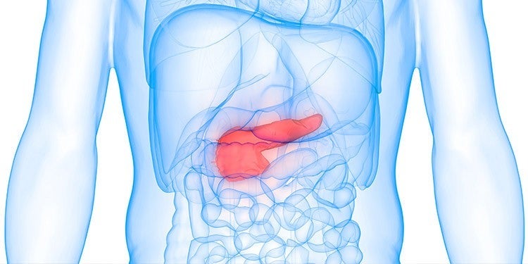 pancreatic cancer