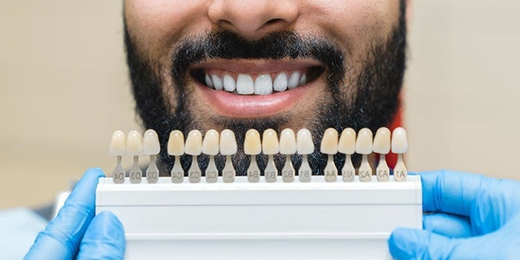 types of veneers